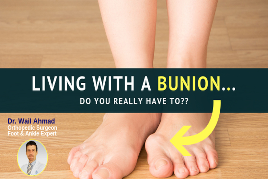 Living with a Bunion...Do You Really Have To? Living with a Bunion...Do You Really Have To?